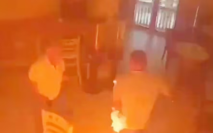 Bàn tay trái người đàn ông bị bén lửa. Ảnh: Las Postas