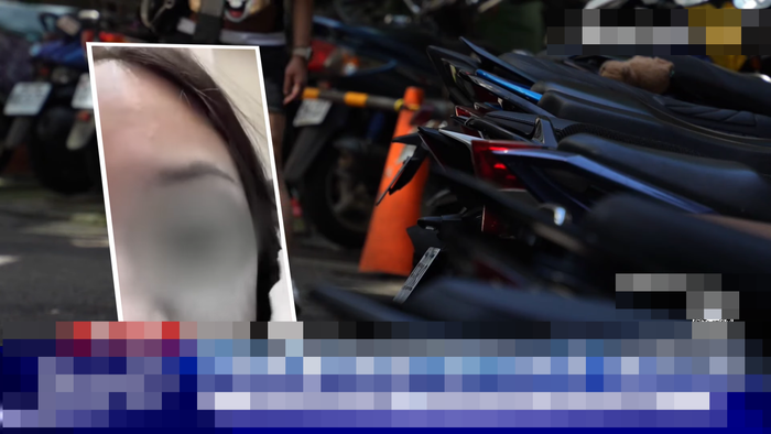 Từ chối quay lại sau chia tay, hành động của bạn trai khiến cô gái bị mù mắt Ảnh 2