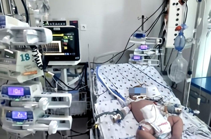 Bệnh nhi rơi vào tình trạng sốc sốt xuất huyết, phải thở máy.