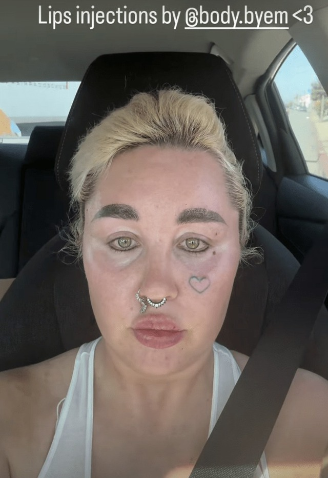 Không còn nhận ra 'nữ hoàng phim teen' một thời Amanda Bynes với diện mạo khác lạ mới đây. (Ảnh: Page Six)