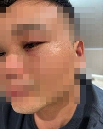 Ăn nhầm cua hấp 3 triệu đồng, người đàn ông bị hàng xóm kéo ra đường đánh hội đồng Ảnh 2