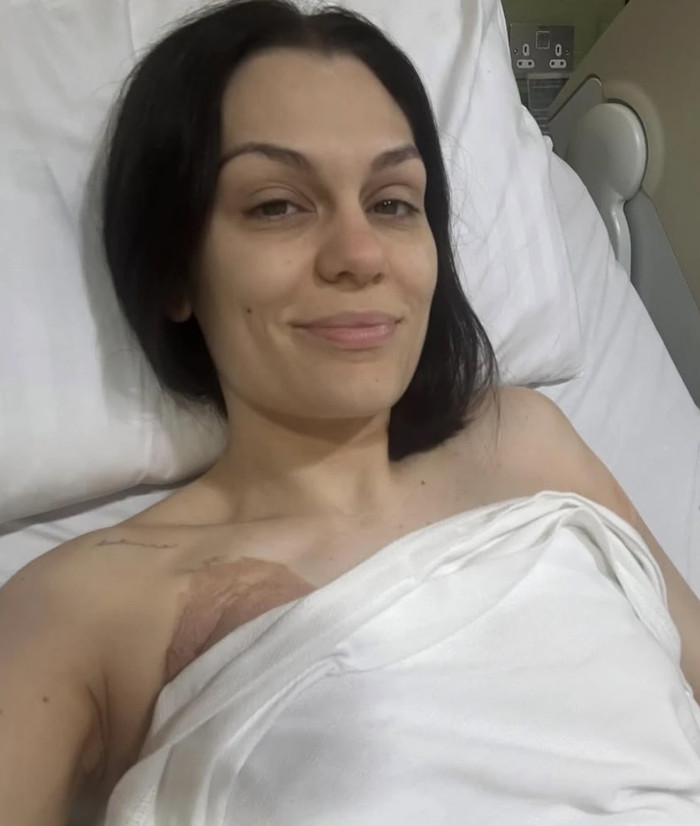 Jessie J hủy toàn bộ show diễn để phẫu thuật ung thư vú lần hai Ảnh 2