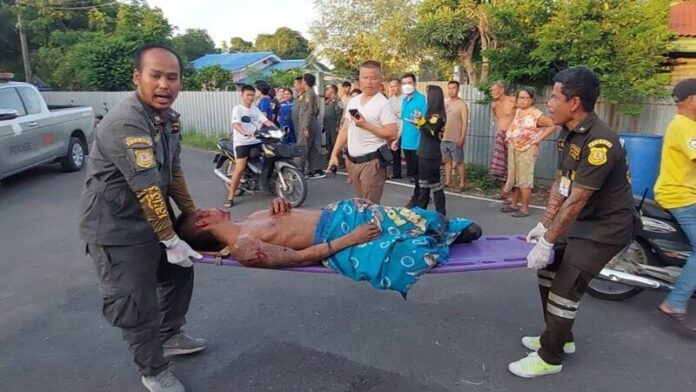 Đi hái măng nhưng nhặt phải quả bom, 2 người bị thương nặng vì vụ nổ kinh hoàng Ảnh 2