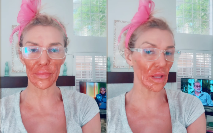 Brandi Glanville thừa nhận đã để sản phẩm tẩy lông trên mặt trong 7 phút, dẫn đến việc vùng da này bị bỏng nặng. (Ảnh: Chụp màn hình)