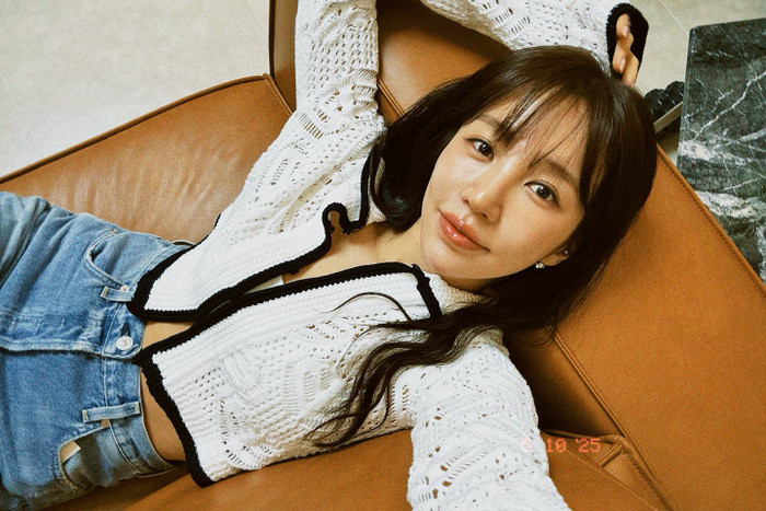 Nữ ca sĩ bị tạt axit, suýt mù mắt Ảnh 3