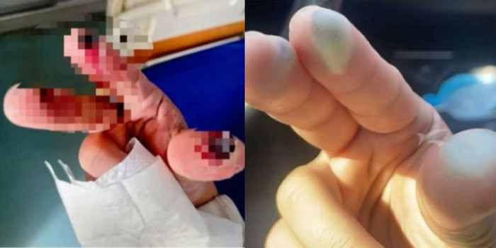 Đi dạo rồi vô tình giẫm phải thùng chứa chất lỏng, người phụ nữ qua đời ngay sau đó Ảnh 2