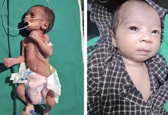 Ảnh minh họa từ một trường hợp tương tự vào năm 2019.