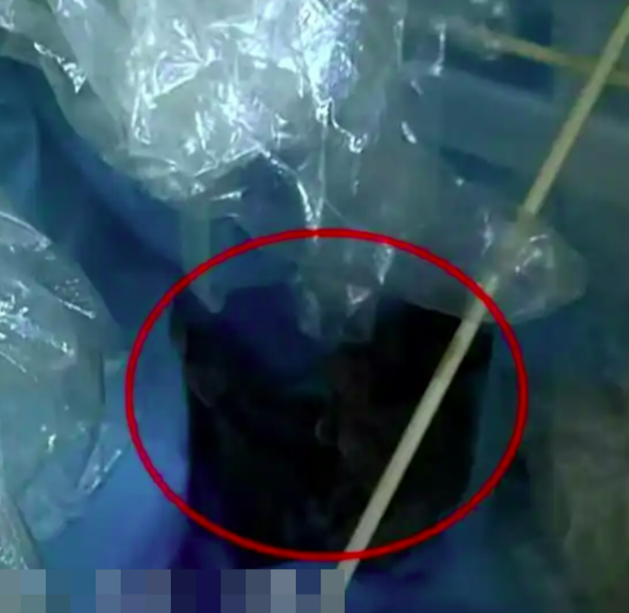 Cơ thể liên tục bốc ra mùi hôi lạ, người phụ nữ đi bệnh viện kiểm tra thì phát hiện sự việc kinh hoàng Ảnh 2