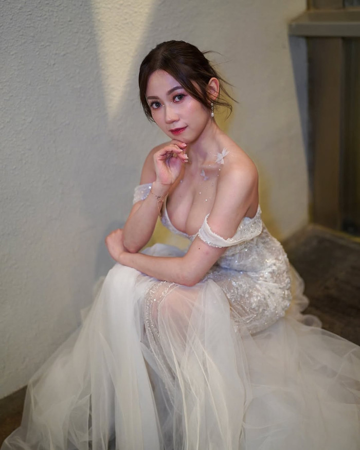 Hiện tại, thị lực của nữ diễn viên TVB đã cải thiện. (Ảnh: IGNV)