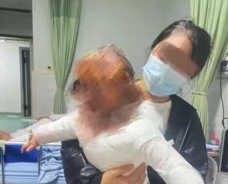 Bình đun nước sôi phát nổ trong nhà, bé trai 1 tuổi bị bỏng 40% cơ thể Ảnh 1