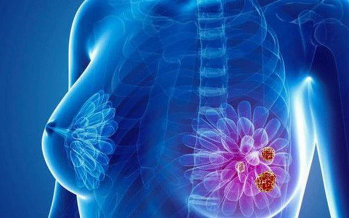 Đậu nành giúp giảm nguy cơ ung thư vú. Ảnh minh họa