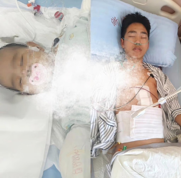 Chàng trai hiến gan cứu con gái, xuất viện sớm và tự thay băng hậu phẫu thuật để tiết kiệm tiền Ảnh 4