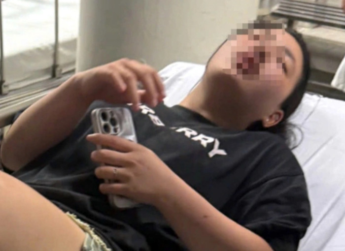 Cô gái phải nhập viện sau khi bị đánh hội đồng.