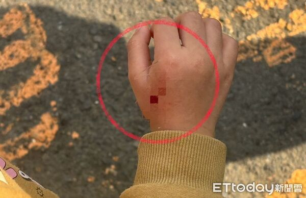 Bé gái 4 tuổi bị chó cắn, thái độ của chủ vật nuôi khiến cha mẹ quyết khởi kiện Ảnh 1