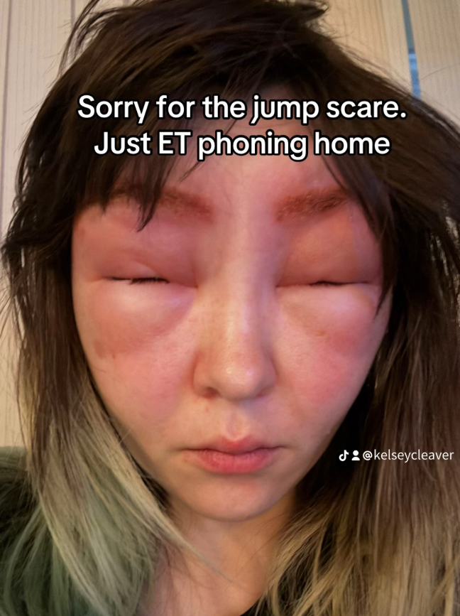 Nữ Tiktoker tá hỏa khi gương mặt biến dạng sau một lần nhuộm lông mày.