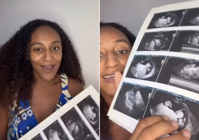 Đang mang thai, người phụ nữ 24 tuổi nhận cú sốc khó tin khi đi siêu âm Ảnh 1