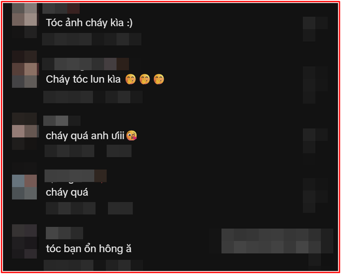 Nam ca sĩ bị cháy tóc khi đang biểu diễn, cộng đồng mạng 'thót tim' Ảnh 5