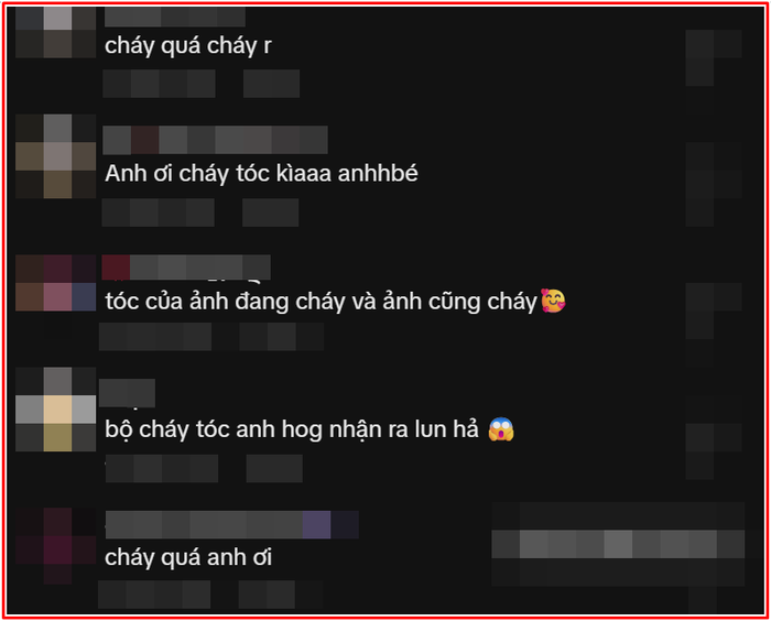 Nam ca sĩ bị cháy tóc khi đang biểu diễn, cộng đồng mạng 'thót tim' Ảnh 4