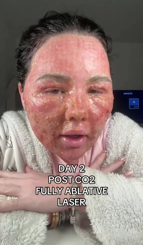 Stevie nhận ra rằng da mặt mình 'rất cứng' và 'có những lớp vảy bong ra'. Ảnh: tiktok/@steviethatautisticbaddie