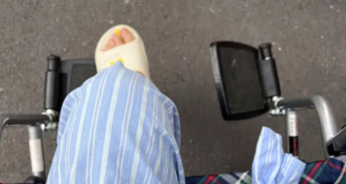 Sau khi được chẩn đoán mắc ung thư xương vào năm 2021, bệnh tình tiến triển nhanh chóng, dẫn đến việc phải cắt cụt chân phải một năm sau đó. Ảnh: QQ.com