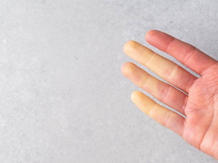 Ảnh minh họa&nbsp;