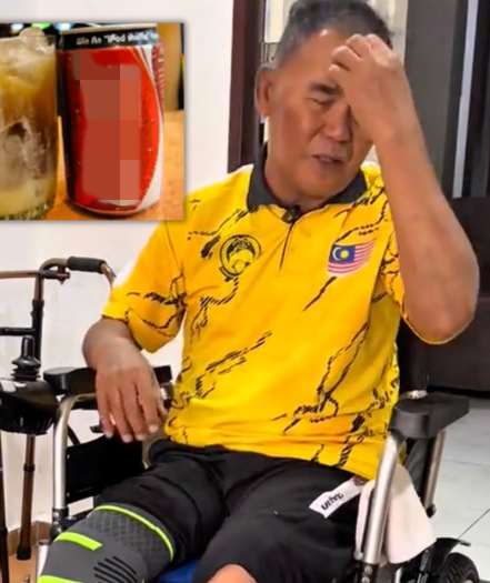 Uống nước ngọt mỗi ngày, người đàn ông phải cưa bỏ 2 chân Ảnh 2