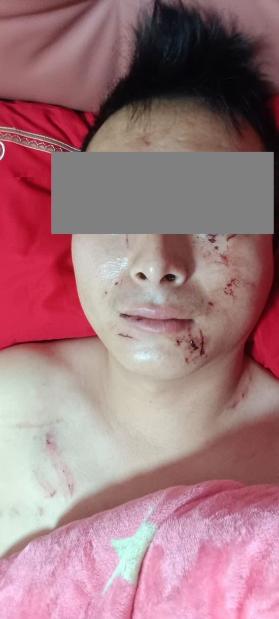 Phát hiện bí mật của vợ ngay trong đêm tân hôn, người đàn ông lập tức đòi ly dị Ảnh 1