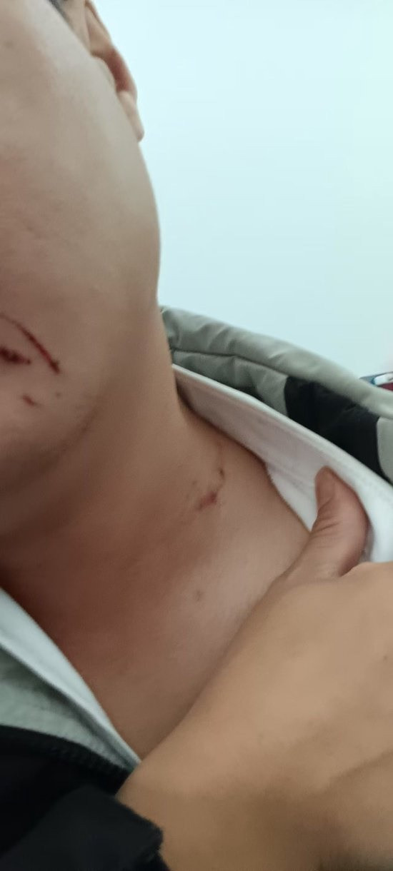 Phát hiện bí mật của vợ ngay trong đêm tân hôn, người đàn ông lập tức đòi ly dị Ảnh 2