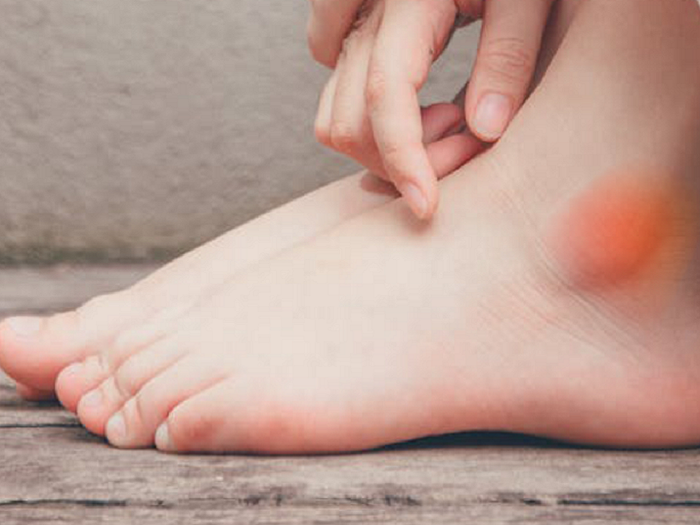 Có 2 dấu hiệu đi lại này thì cảnh giác bệnh suy thận sắp 'ghé thăm' Ảnh 2