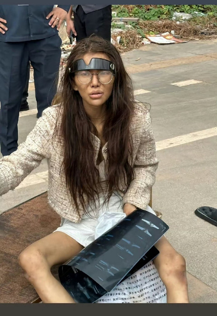 Cô gái nổi tiếng bị bạn trai dụ sang Campuchia 'làm giàu, được tìm thấy với đôi chân bị gãy Ảnh 2