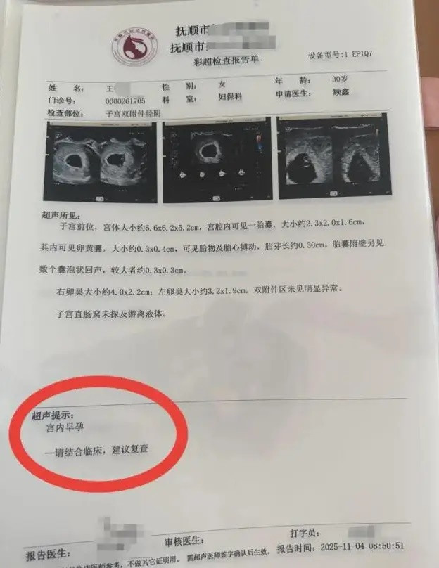 Đi khám thai, người phụ nữ 30 tuổi sốc khi số lượng em bé trong bụng thay đổi mỗi lần siêu âm Ảnh 1