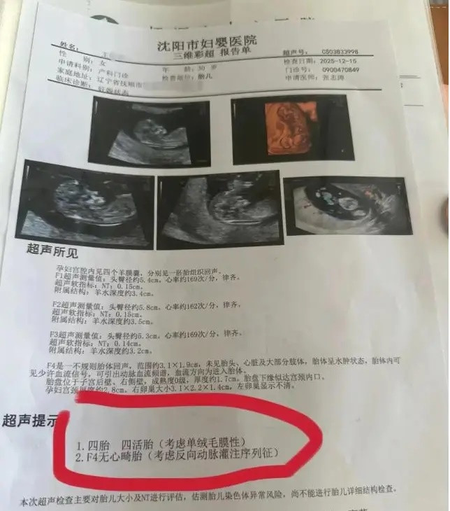 Đi khám thai, người phụ nữ 30 tuổi sốc khi số lượng em bé trong bụng thay đổi mỗi lần siêu âm Ảnh 4