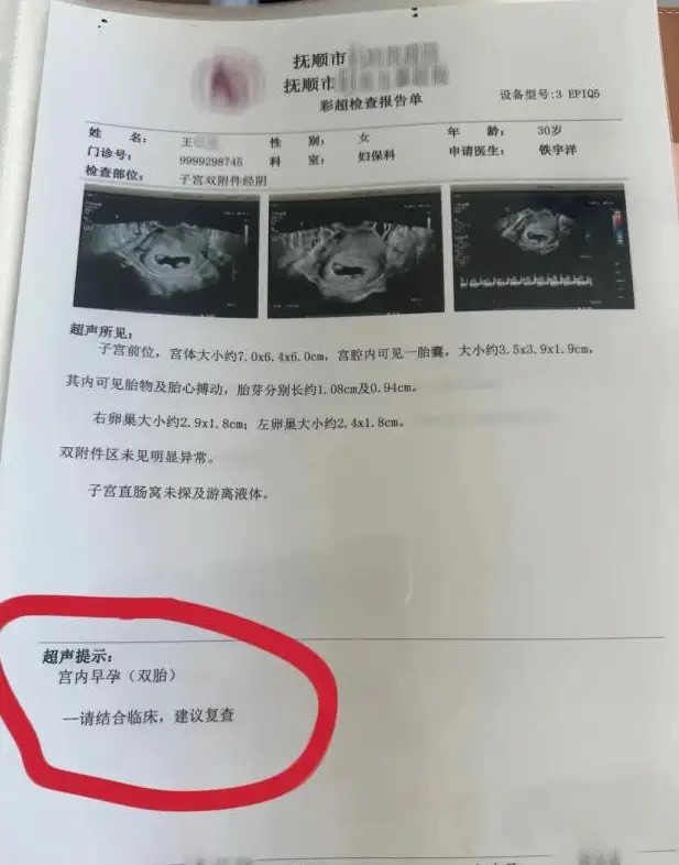 Đi khám thai, người phụ nữ 30 tuổi sốc khi số lượng em bé trong bụng thay đổi mỗi lần siêu âm Ảnh 2