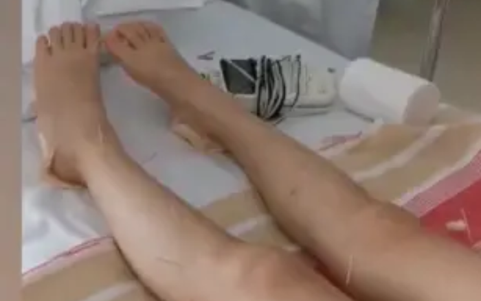 Bé gái 6 tuổi bị liệt suốt đời sau buổi học múa, cha mẹ bức xúc vì suốt 7 năm chưa nhận được lời xin lỗi Ảnh 1