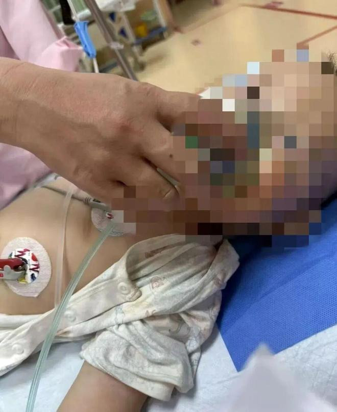 Bé trai 1 tuổi nguy kịch sau khi ăn quả trứng, lời khai của người hàng xóm gây phẫn nộ Ảnh 1