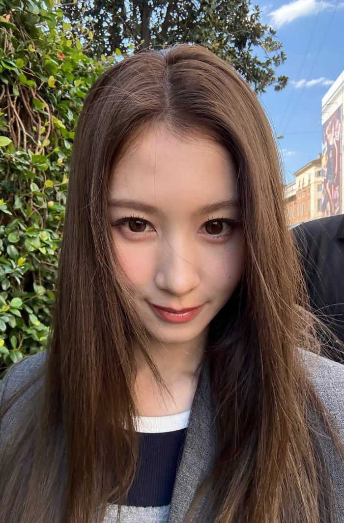 Thân hình gầy gò đáng lo của Sana (TWICE) Ảnh 3