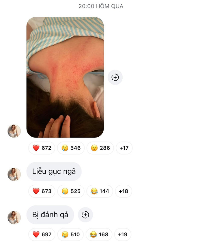 Ninh Dương Lan Ngọc chia sẻ về tình trạng đáng lo.