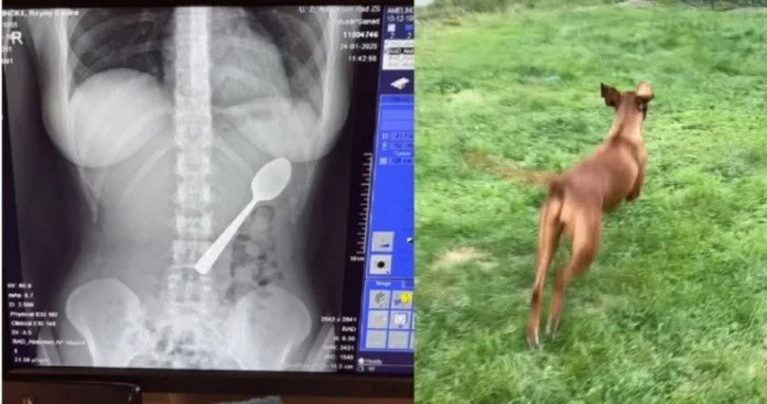 Bị chó cưng bất ngờ nhảy lên người, cô gái nuốt chiếc muỗng dài 17cm vào dạ dày Ảnh 1