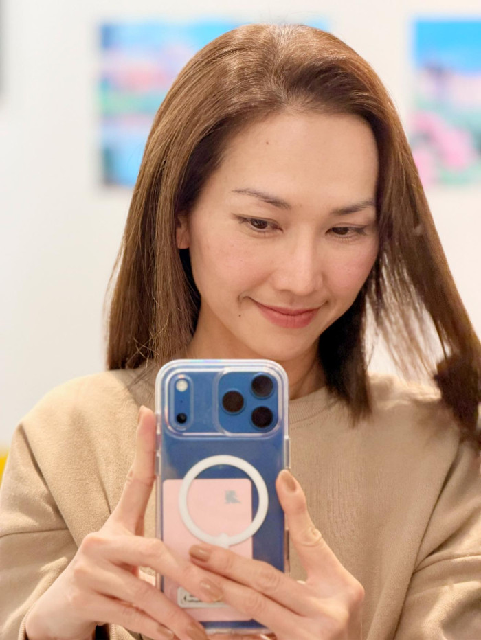 Kim Hiền là một trong những diễn viên Việt đã thực hiện phẫu thuật thẩm mỹ. Ảnh: FBNV