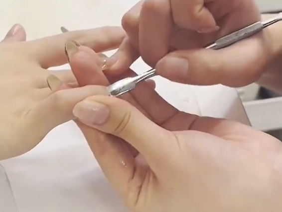 Người phụ nữ mắc 'bệnh lạ' sau khi làm móng, bác sĩ chỉ ra nguyên nhân Ảnh 4