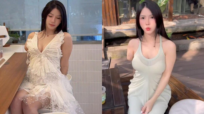 Cô gái mất một tay vì tai nạn lao động, cuộc sống khiến nhiều người nể phục Ảnh 1