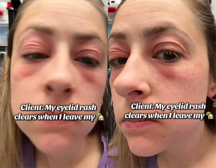 Chi hơn 9 tỷ đồng mua nhà, cô gái 28 tuổi mắc bệnh lạ sau 2 ngày vào ở Ảnh 4