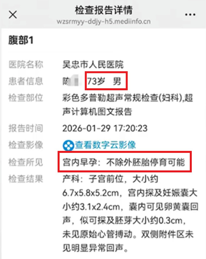 Ông cụ 73 tuổi được chẩn đoán có thai trong tử cung, sự thật sau đó 'gây sốc' Ảnh 2
