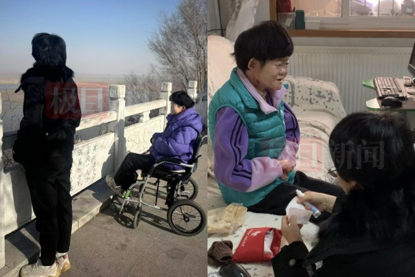 Cô gái có làn da 'mong manh như cánh bướm' từng bị bác sĩ nói sống không quá 2 tuổi, cuộc sống hiện tại khiến ai cũng xúc động Ảnh 3