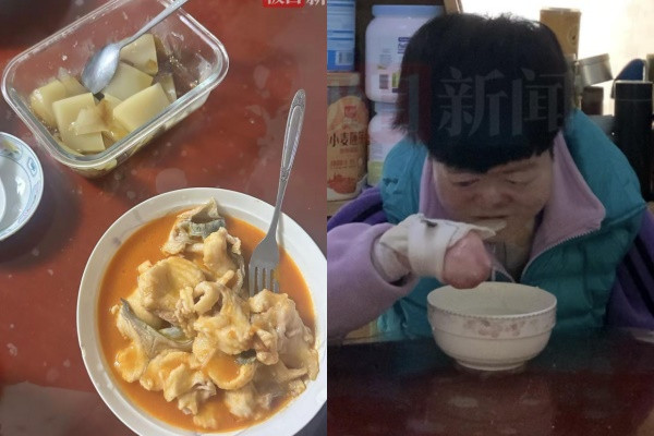 Cô gái có làn da 'mong manh như cánh bướm' từng bị bác sĩ nói sống không quá 2 tuổi, cuộc sống hiện tại khiến ai cũng xúc động Ảnh 2