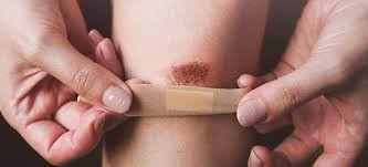 5 dấu hiệu ung thư thường bị bỏ qua vì quá giống bệnh vặt Ảnh 3