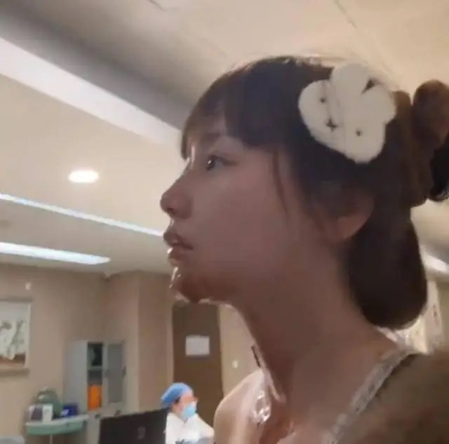 Bắt trend 'bánh sinh nhật phun lửa', nữ diễn viên 27 tuổi gặp tai nạn kinh hoàng Ảnh 3