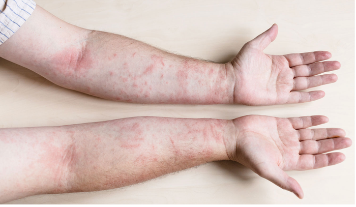 Trái cây tốt đến mấy cũng không nên ăn khi cơ thể có 3 dấu hiệu này Ảnh 4