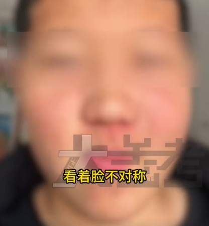 Bé trai 15 tuổi mặt sưng, miệng méo, đi chụp CT bác sĩ phát hiện sự thật bất ngờ Ảnh 2