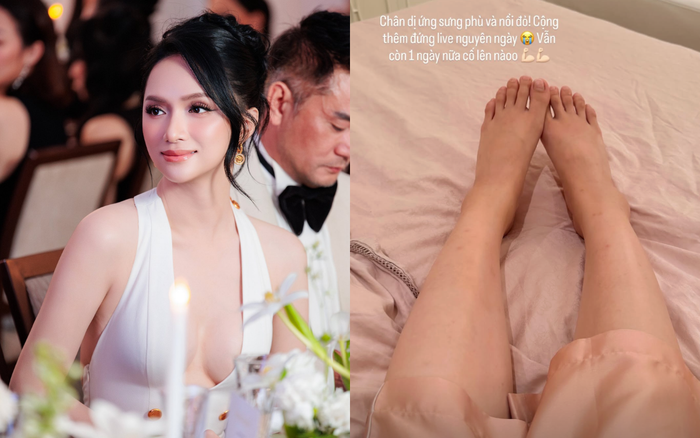 Hương Giang gặp sự cố sức khoẻ ngoài ý muốn. Ảnh: IGNV